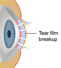 eye1